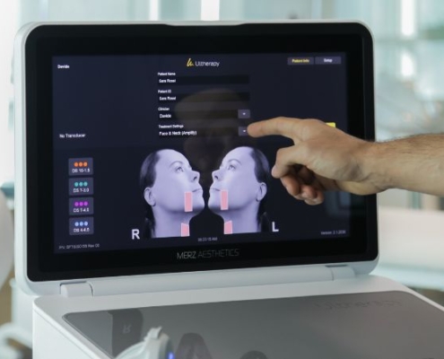 Integrare lo skinlifting Ultherapy PRIME® in studio: perché?