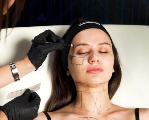 Slow aging e medicina estetica: equilibrio tra naturalezza e intervento