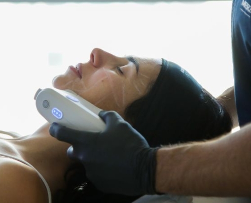 Ultherapy PRIME®perché gli ultrasuoni microfocalizzati non sono un semplice lifting non invasivo