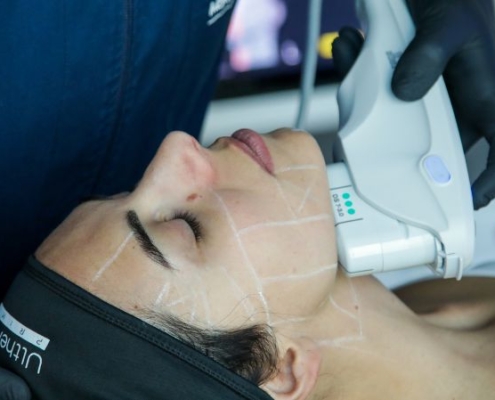 Skin lifting a base di energia il futuro della medicina estetica